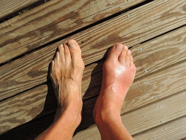 L&rsquo;importance du kinésithérapeute dans la récupération après une opération du pied